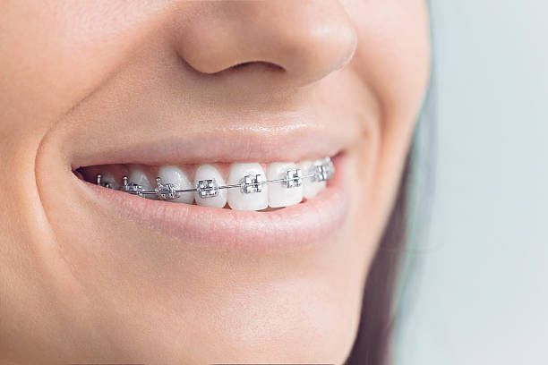 Oral Cancer Screening in Orange, CA